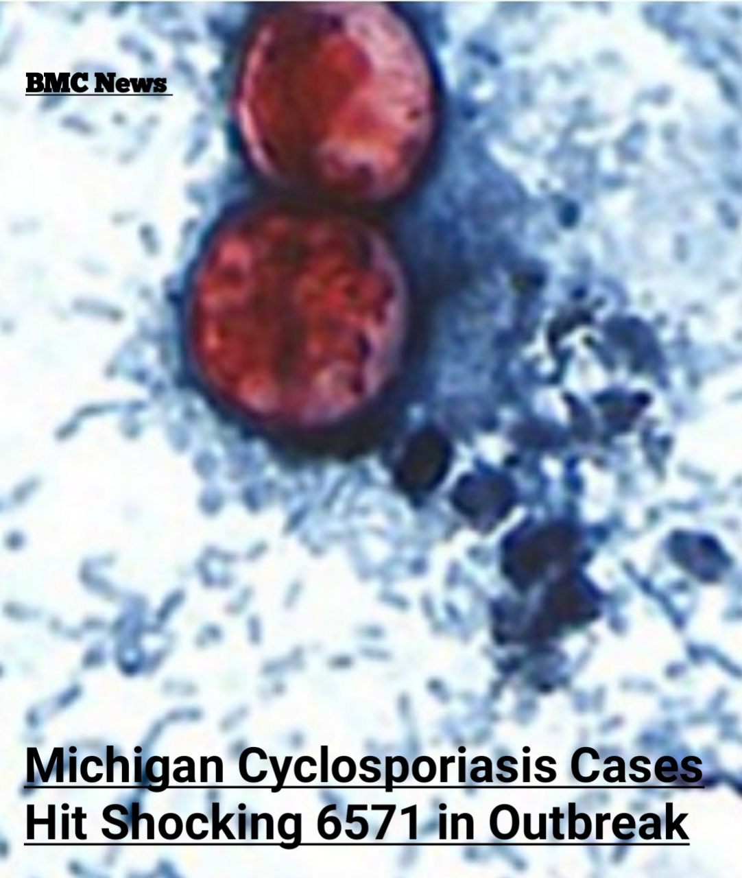 Michigan cyclosporiasis cases map showing 6571 confirmed infections across 55 counties in the 2026 outbreak
